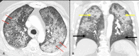 Fig 1: