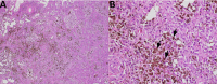 Fig 4:
