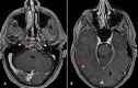 Fig 6: