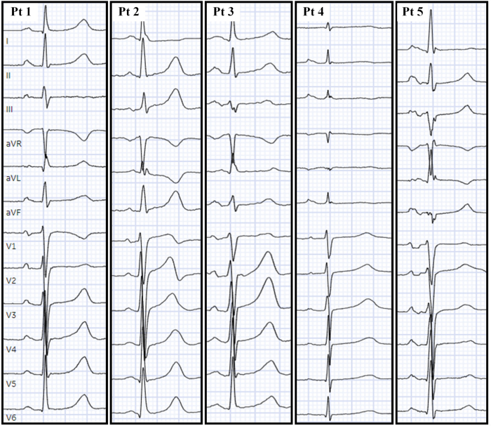 Figure 1