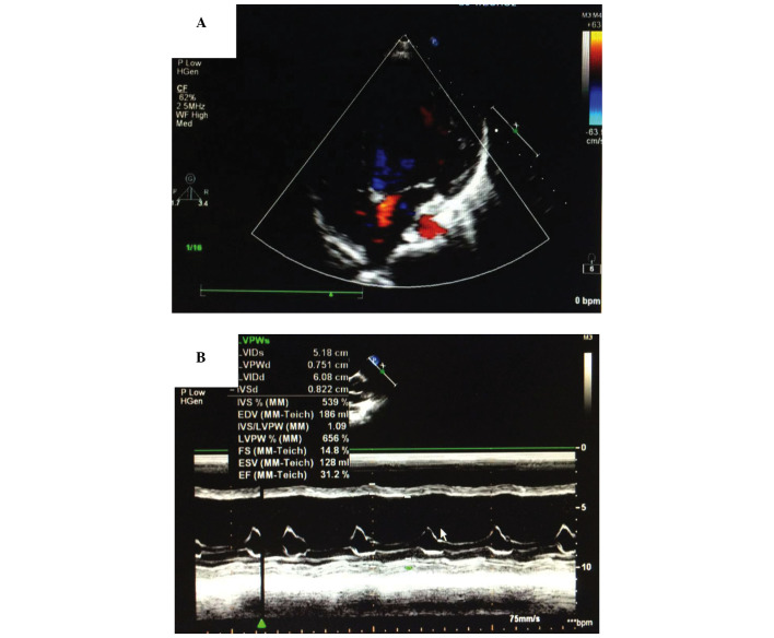 Figure 2.