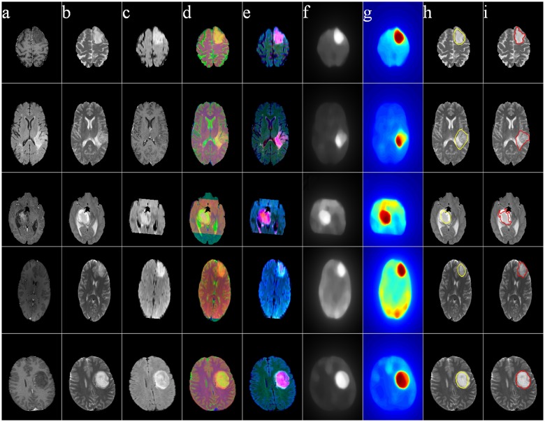 Fig 12