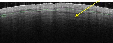 FIGURE 18.