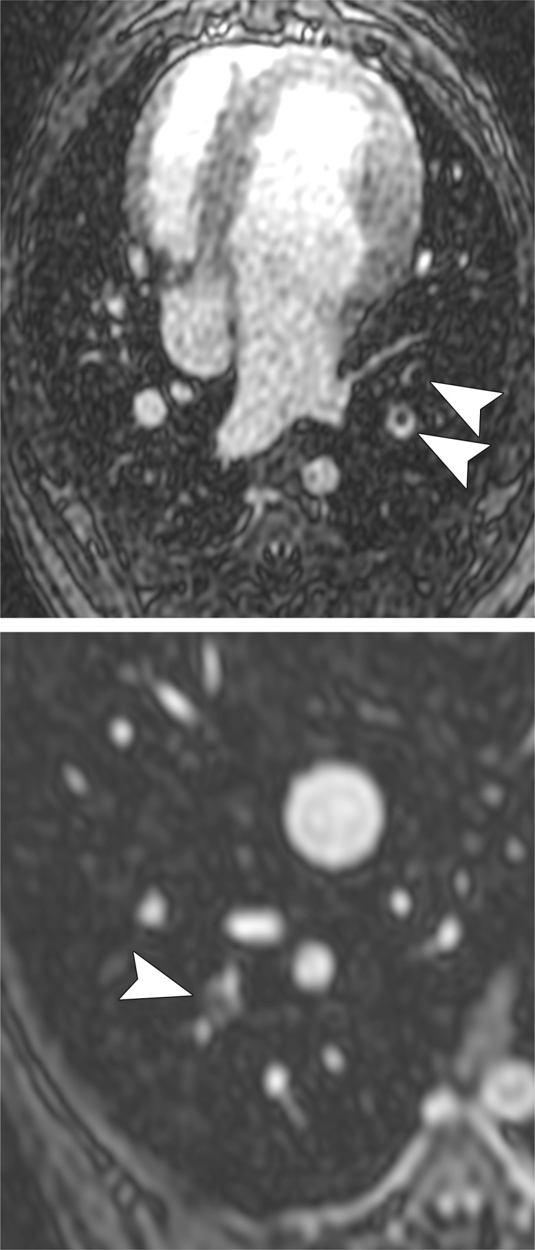 Figure 1a: