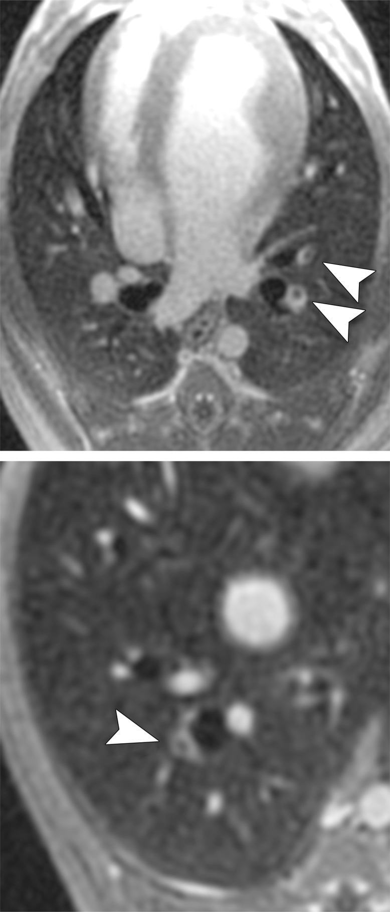 Figure 1b: