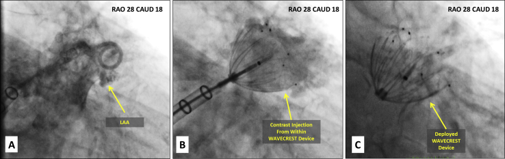 Figure 4