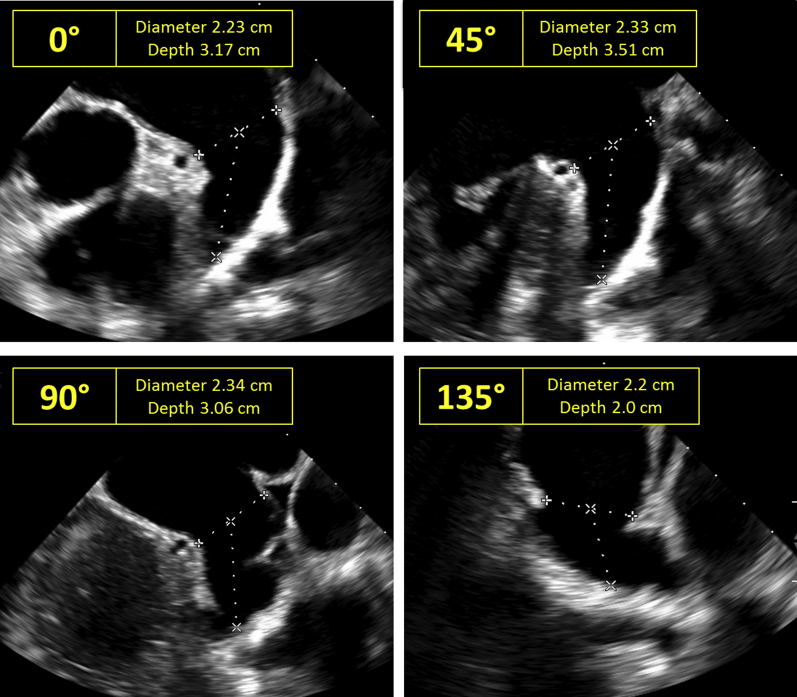 Figure 2