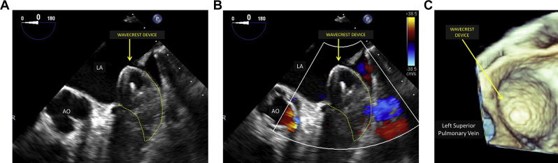 Figure 5