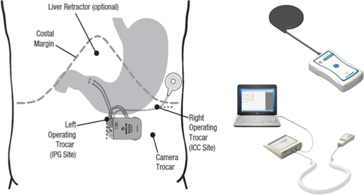 Fig. 1