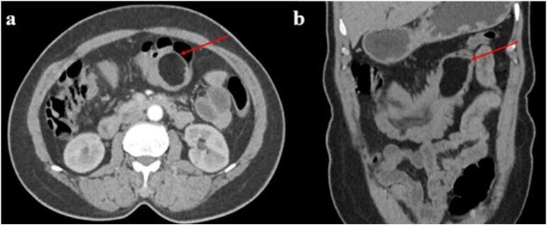 Fig. 2