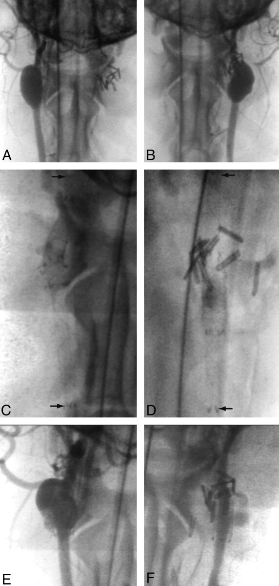 Fig 2.