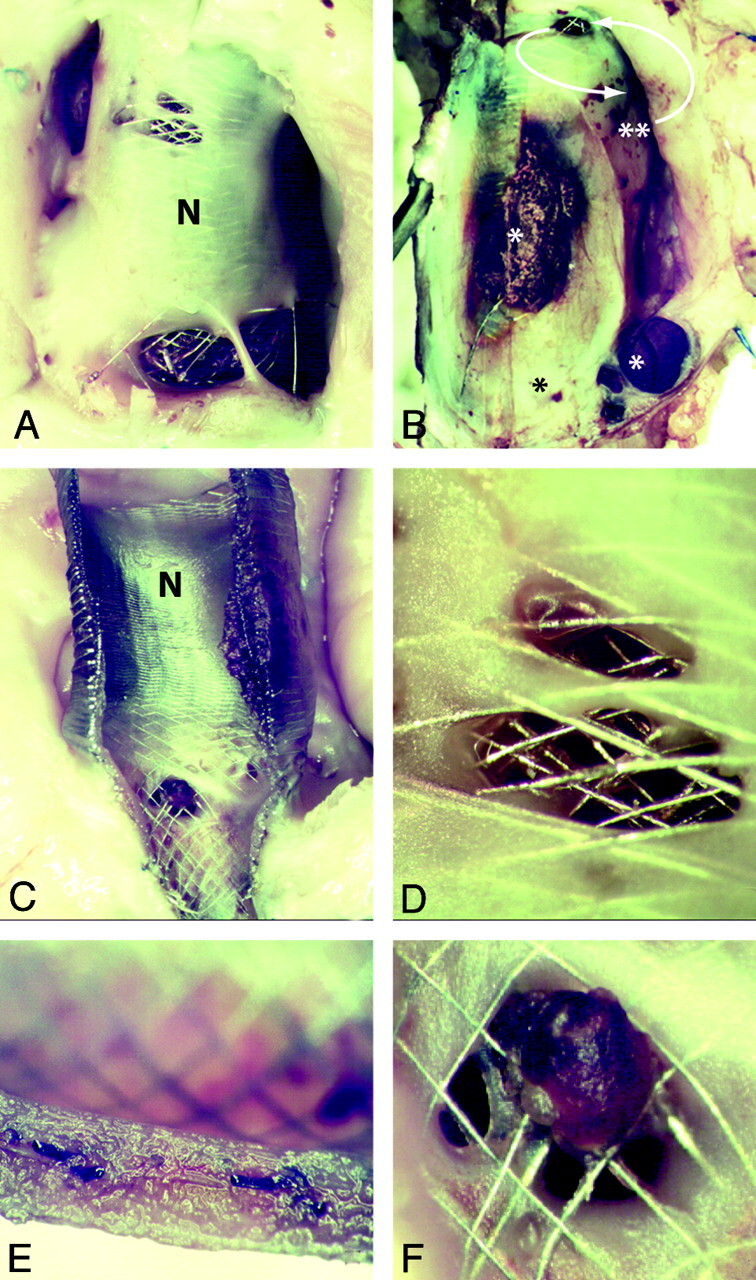 Fig 3.