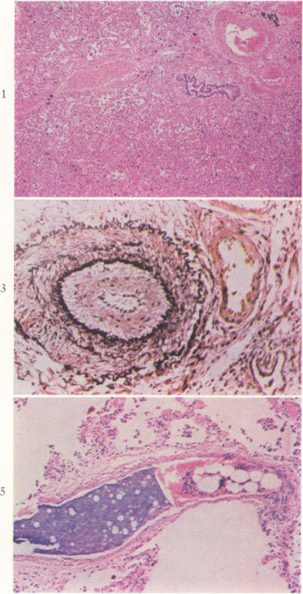 Fig. 1., Fig. 3., Fig. 5.