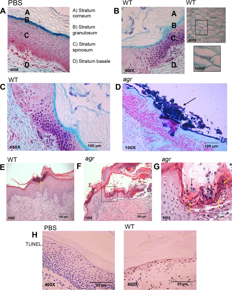 FIG 4 