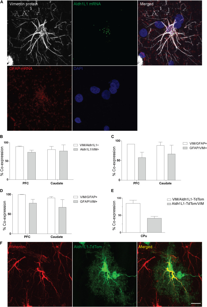 Characterization of Vimentin-Immunoreactive Astrocytes in the Human ...