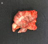 Fig. D