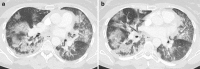 Fig. 9