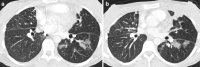 Fig. 14