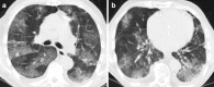 Fig. 11