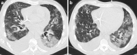 Fig. 13