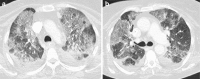 Fig. 10