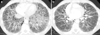 Fig. 12