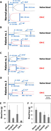 Fig. 4