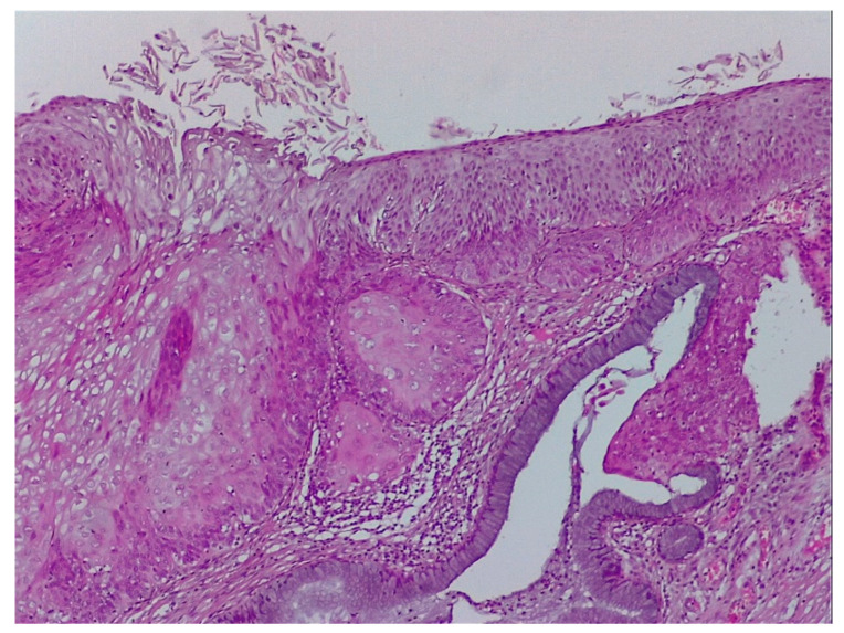 Figure 13