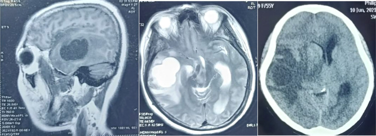 Figure 3