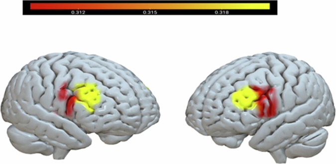 Fig. 3