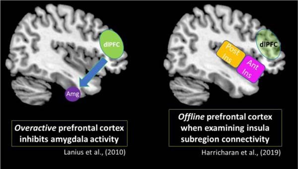 Box 2. Parallel Neural Processes in the PTSD Dissociative Subtype.