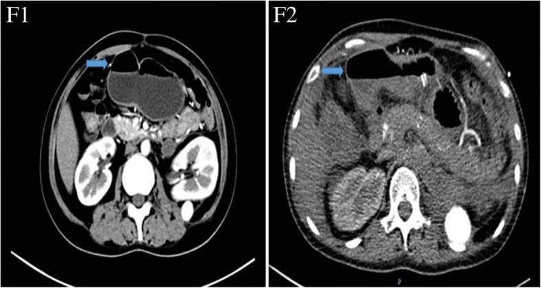 Fig. 6