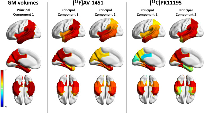 Figure 2 Principal components of the multimodal imaging. 