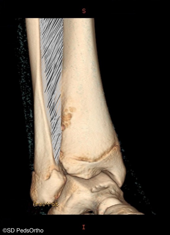 Fig. 4