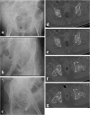 Fig. 6