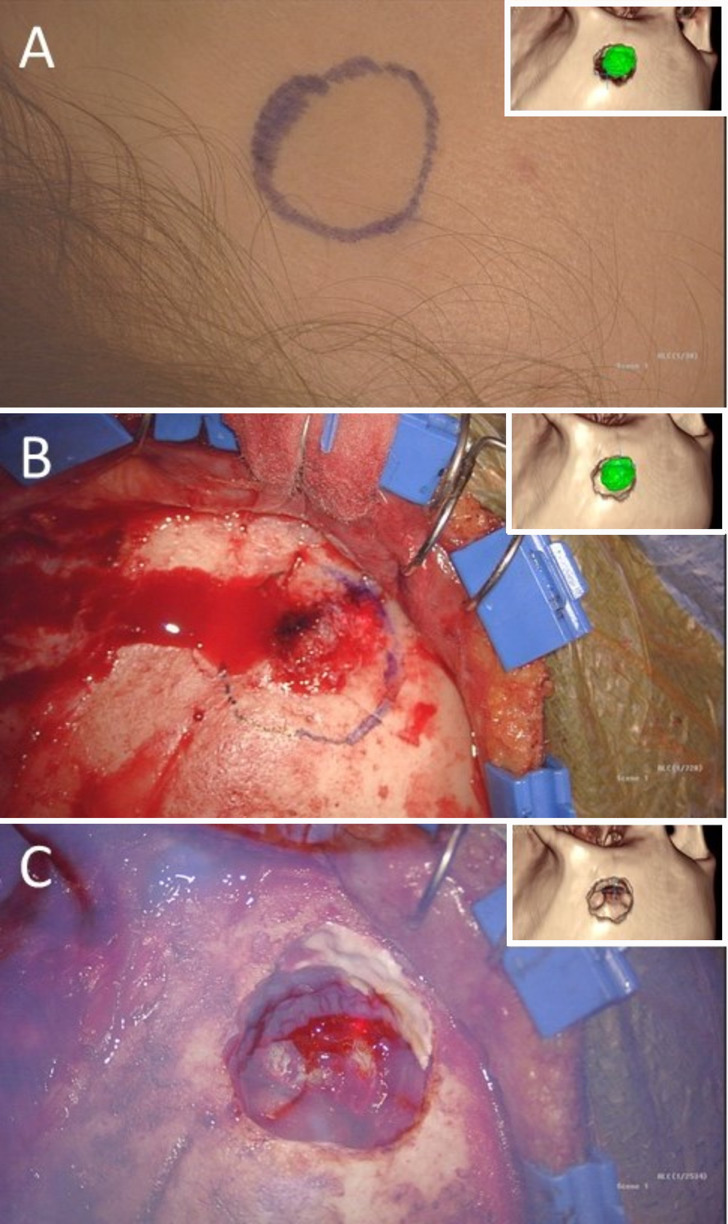 FIG. 4.