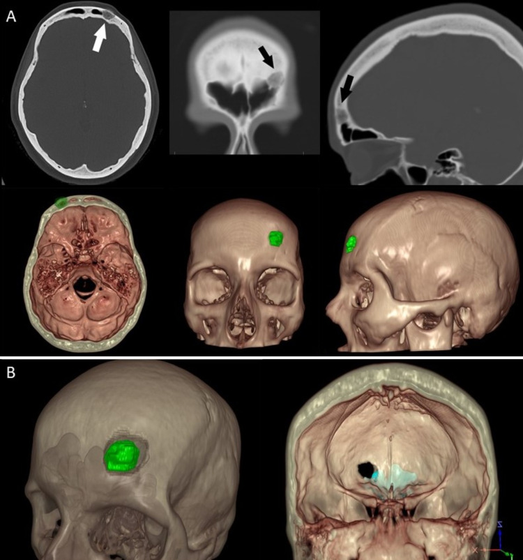 FIG. 2.