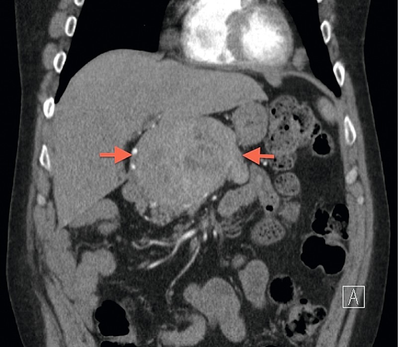 Fig. 1