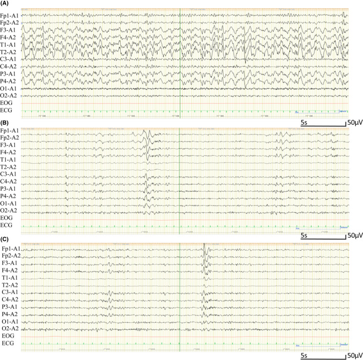 FIGURE 3