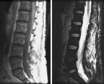 Fig. 12