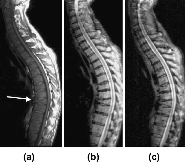 Fig. 10