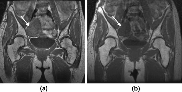 Fig. 5