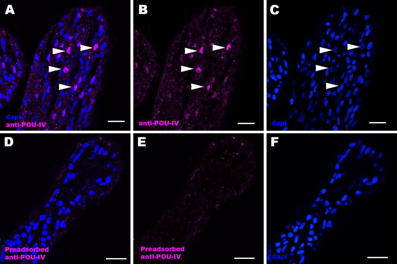 Figure 2—figure supplement 3.