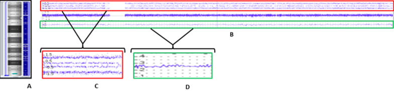 Fig. 2