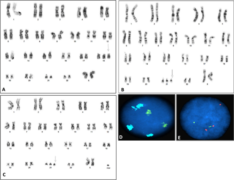 Fig. 1