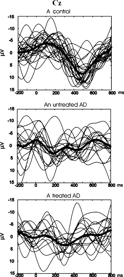 Fig. 2