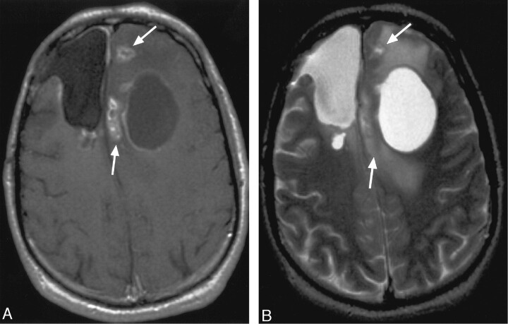 Fig 3.