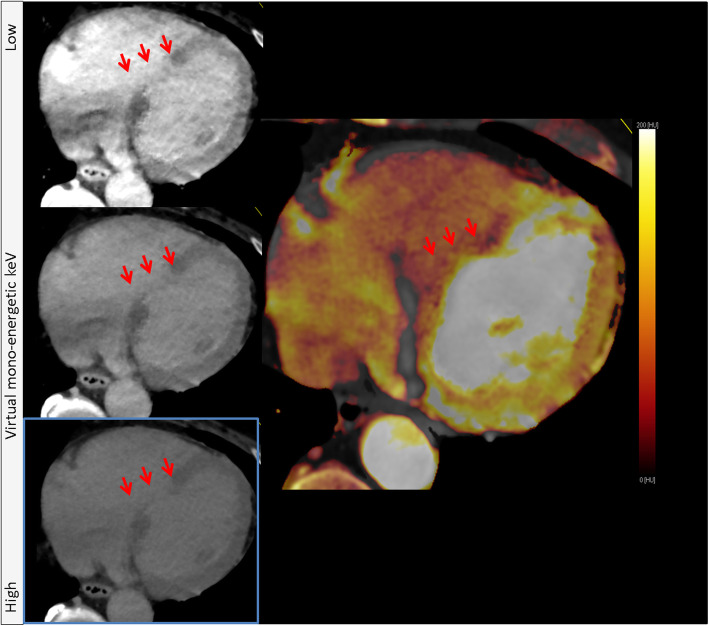 Fig. 7