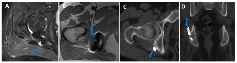 Figure 11