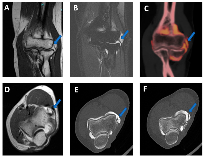 Figure 9